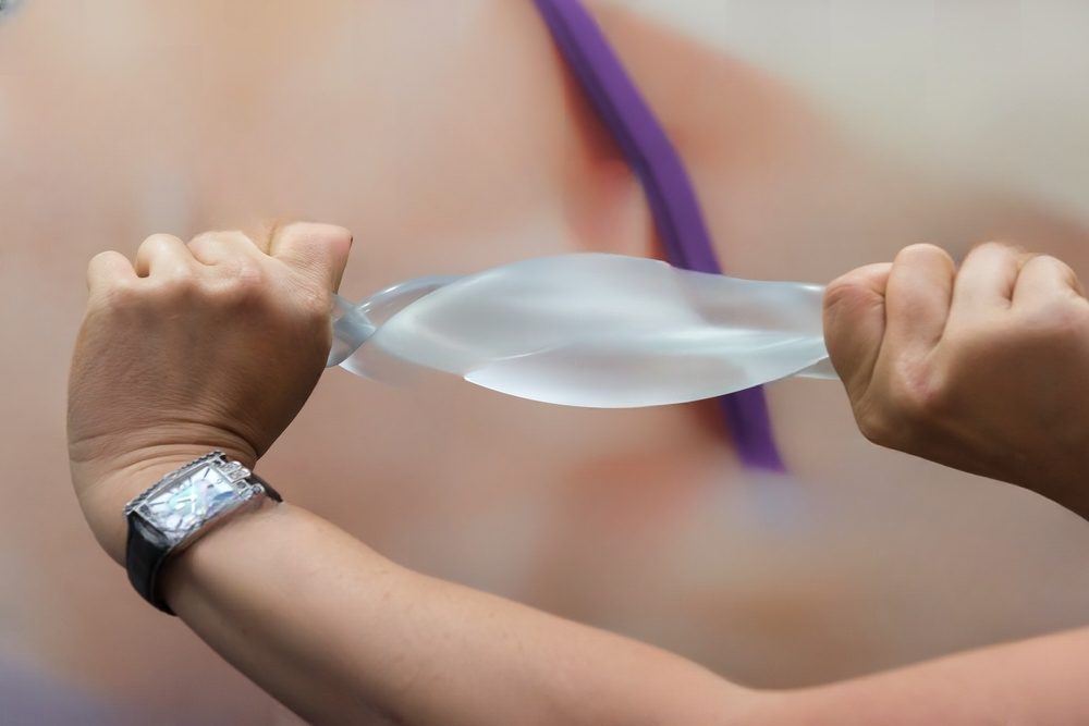 silicon implant being twisted